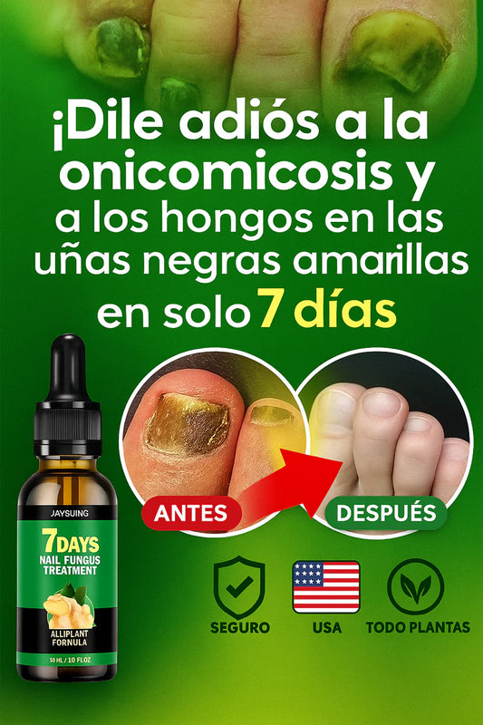 MycoStop™: Elimina hongos, onicomicosis y uñas negras o amarillas en solo 7 días