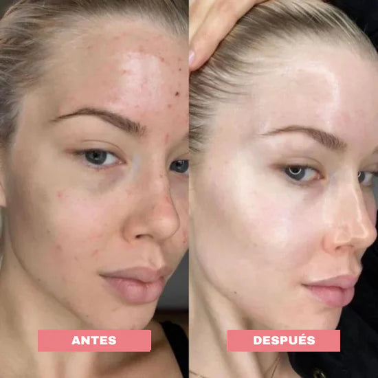 SkinElixir™ - Mascarilla de colágeno, el secreto coreano