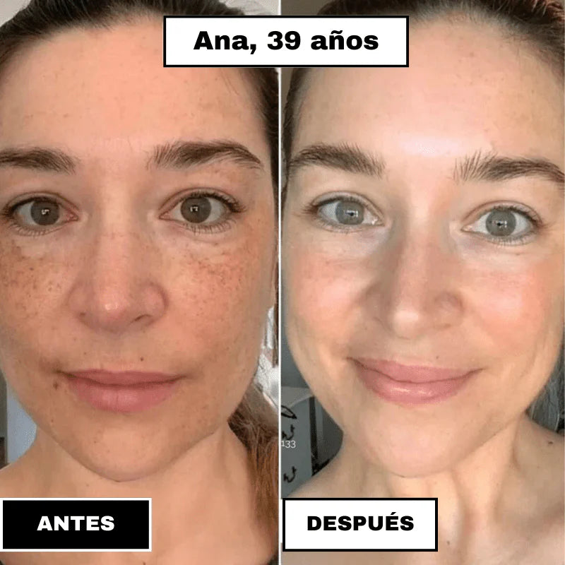 SkinElixir™ - Mascarilla de colágeno, el secreto coreano