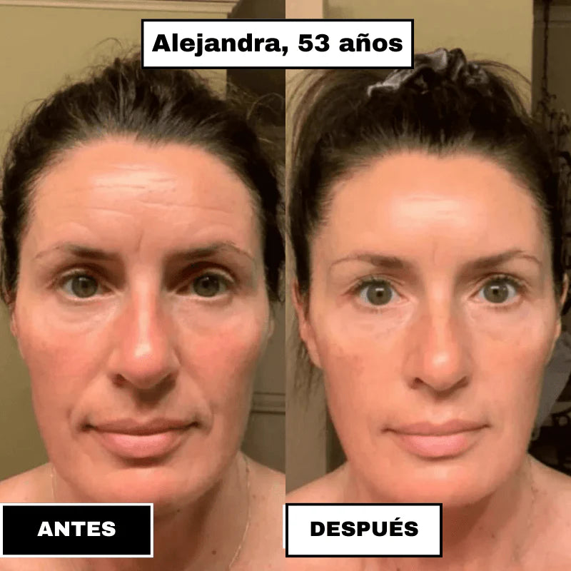 SkinElixir™ - Mascarilla de colágeno, el secreto coreano