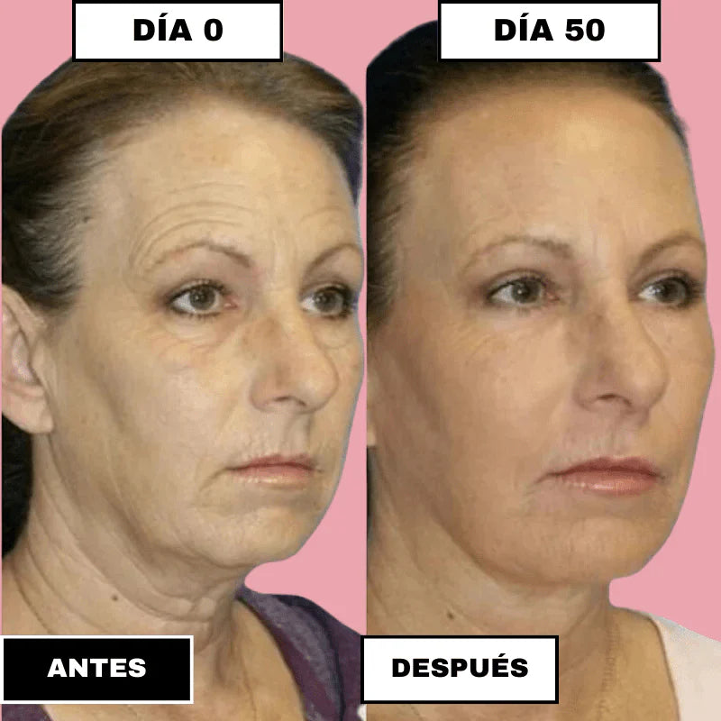 SkinElixir™ - Mascarilla de colágeno, el secreto coreano