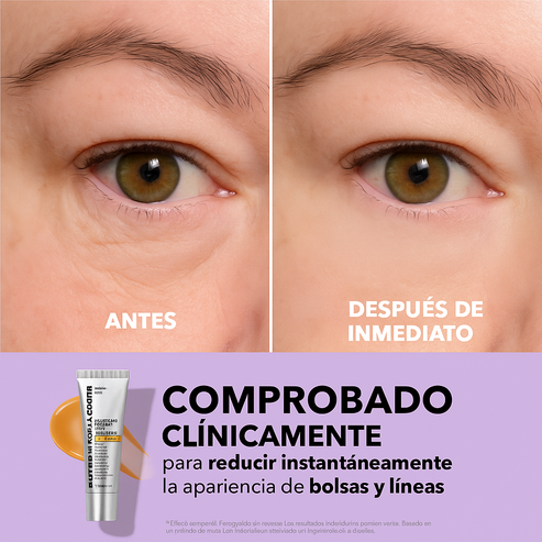 Tensor de Ojos Pether Thomas: Reduce Arrugas y Ojeras en 5 Minutos