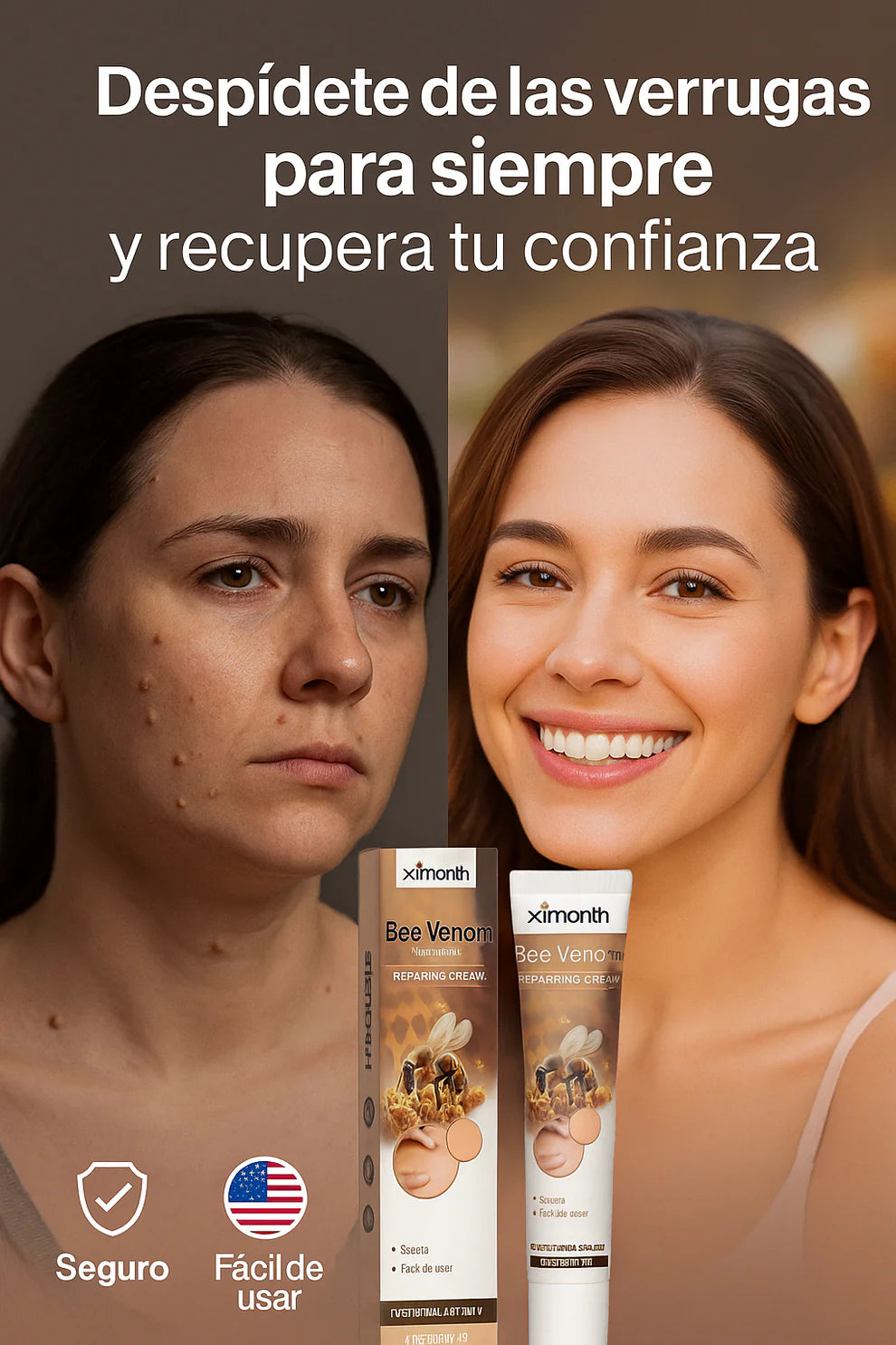 BeeDerm Pro – Elimina Verrugas y Fibromas en Solo 3 Días, Sin Cirugías ni Dolor